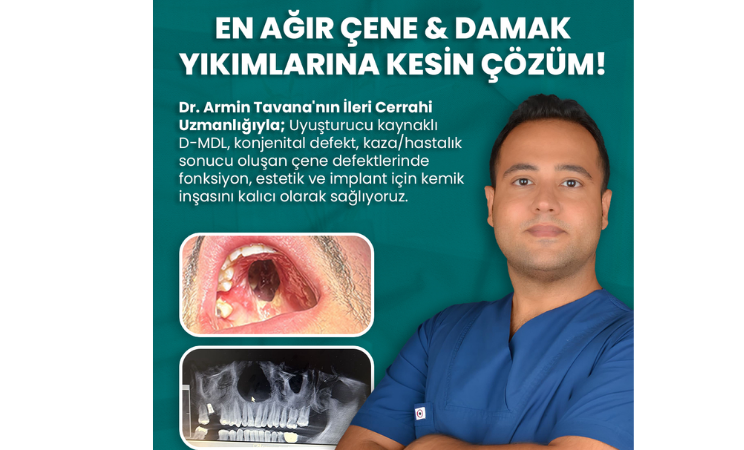 Elysiora Dental Dr. Armin Tavana’nın Uzmanlığında İleri Çene Cerrahisi